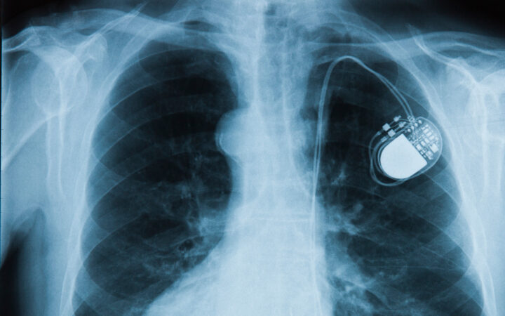 sh-pacemaker4